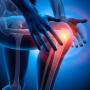 Как лечить коленный синовит?